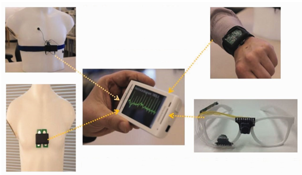 Four wearable sensors connected to a smartphone that can provide sources of health data. Counterclockwise from the top left: AutoSense providing ECG, respiration and acceleration data; EasySense providing heat motion, lung motion and lung fluid level data; iShadow Eyeglass providing an outward video camera and an inward infrared camera; and Smartwatch with accelerometers and gyroscopes(10.1093/jamia/ocv056)